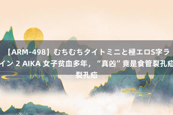 【ARM-498】むちむちタイトミニと極エロS字ライン 2 AIKA 女子贫血多年，“真凶”竟是食管裂孔疝