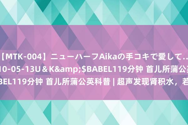 【MTK-004】ニューハーフAikaの手コキで愛して…。</a>2010-05-13U＆K&$BABEL119分钟 首儿所蒲公英科普 | 超声发现肾积水，若何办？